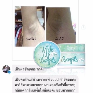 ของแท้💯พร้อมส่ง 💙ครีมรักแร้ขาว ไวท์อัพอาร์มพิท💙 (รับตรงจากบริษัท) โปรดระวังของ**ปลอ-ม**