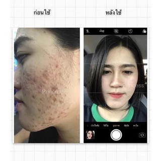 PRINCESS ครีมขมิ้นปริ้นเซส แท้ 100% [รับตรงจากแบรนด์ ] มากดใช้ส่วนลดหน้าไลฟ์ จัดหนักลดเยอะ
