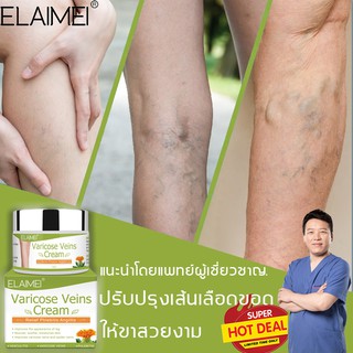 ELAMEIครีมทาเส้นเลือดขอด ยาทาเส้นเลือดขอด50gส่งเสริมการไหลเวียนเลือดบรรเทา ยาเส้นเลือดขอด