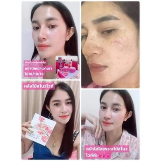 ครีมสโนไวท์ของแท้100%1ชุดประกอบด้วย4ชิ้น💐(เซรั่ม,ครีมกลางวัน,ครีมกลางคืน,สบู่)