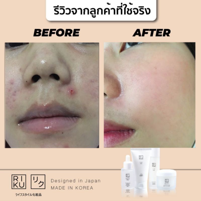 ⚡️โฟม⚡️🌈พร้อมส่ง โฟมล้างหน้า Riku ริคุ โฟมน้ำนมแรก ลดมัน ลดสิว ผิวกระจ่างใส First  Milk Face Cleanser เกาหลี Korea - รูปที่ 6