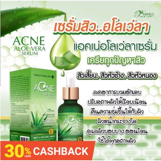 ❇️เซรั่มลดสิว อโลเว่ลา ❇️