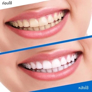 แผ่นแปะฟันขาว 5D White teeth whitening ลดคราบเหลือง