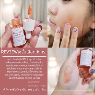 (มีของแถม)🔥เซรั่มลดสิวสูตรออร์แกนิค ของแท้100% Dragons Blood Acne Serum (เซรั่มเลือดมังกร)