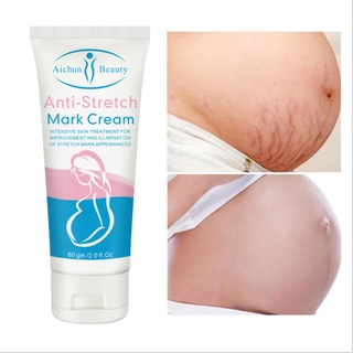 1PC Stretch Mark Cream Naturally Gentle and Non-irritating Repair Stretch Mark Scar Moisturizing Body Lotion