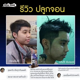ของแท้!!! Real Hair- เซรั่มปลูกผม คิ้ว หนวด จอน -(สูตรหัวเชื้อ) ใช้ได้ทั้ง ช ญ