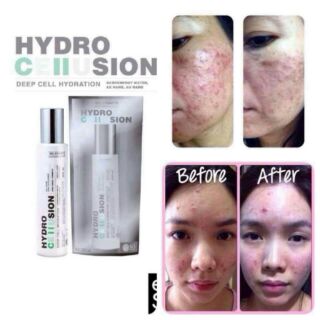 Hydro Cellusion (สเปรย์ ไฮโดร เซลลูชั่น)60 ml.