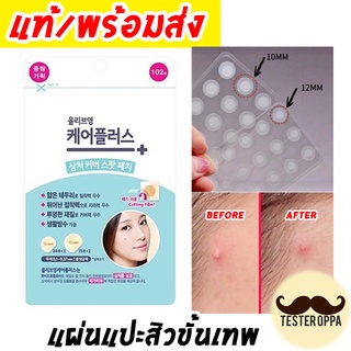 (✔️พร้อมส่ง ถูกสุด ✔️) แผ่นแปะสิว OLIVE YOUNG Care Plus Scar Cover Spot Patch 1ซองมี 102 ชิ้น