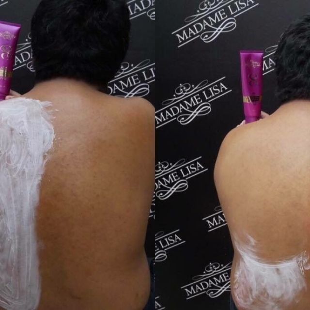 ใช้อะไรไม่เห็นผล
ท้าให้ลอง Body mask sจาก Madame Lisa
เห็นผลเร็ว เพียงทิ้งไว้ 30 นาที •เห็นความแตกต่