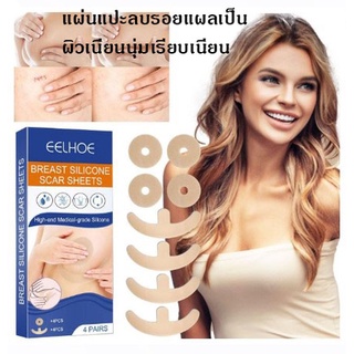 แผ่นแปะลบลอยแผลสมานรอยแผล Breast silicone scar sheets