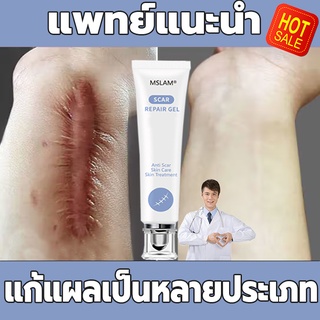 【ฟื้นฟูผิวของคุณ】ครีมทาแผลเป็น 20g ครีมทารอยแผลเป็นแผลไฟไหม้ แผลน้ำร้อนลวก แผลผ่าตัดเป็นต้น แผลเป็นหลายประเภท ยาทาลอยแผล