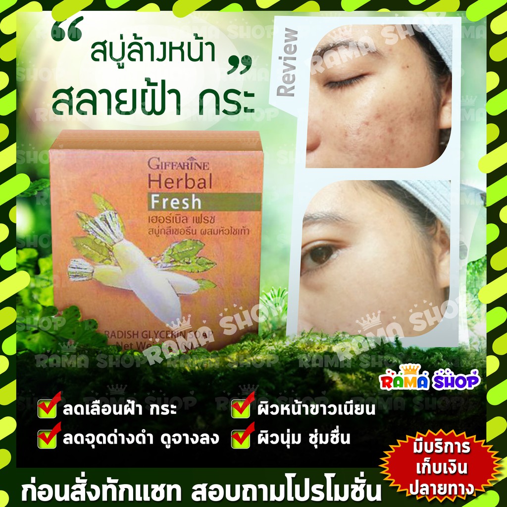 🔥ลดแรง🔥สบู่ลดเลือน สิว ฝ้า กระ เฮอร์บัลเฟรช กลีเซอรีนหัวไชเท้า กิฟฟารีน