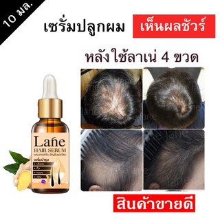 Lane เซรั่มปลูกผม น้ำยาปลูกผม ปลูกคิ้ว ปลูกไรผม แก้ผมร่วง น้ำยาเร่งผมยาว หัวเถิกปลูกผม X1 ขวด