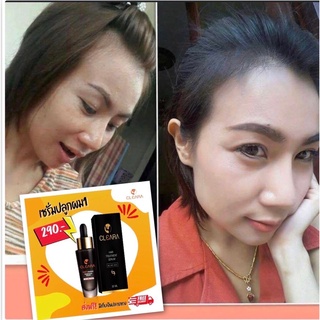 (ส่งฟรีส่งด่วน) Cleara Serum เคลียร่า เซรั่มปลูกผม ลดผมร่วง กระตุ้นผมใหม่ เซรั่มปลูกคิ้ว ผมแข็งแรง เส้นผมแข็งแรง 15 ml.