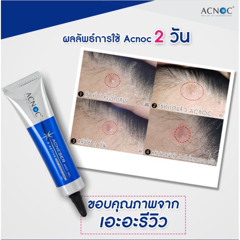 ส่งฟรี💙เจลแต้มสิวACNOC 15g.