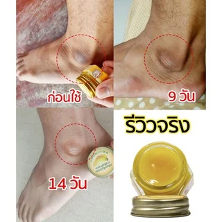 💥ซื้อ 4ชิ้น เพียง199.- บาล์มกล้วยหอมทาส้นเท้าแตก ครีมทาเท้า ตาตุ่มดำ ข้อศอกด้าน ผิวแห้งกร้าน 10กรัม_สมุนไพรเจ้าคุณประชา