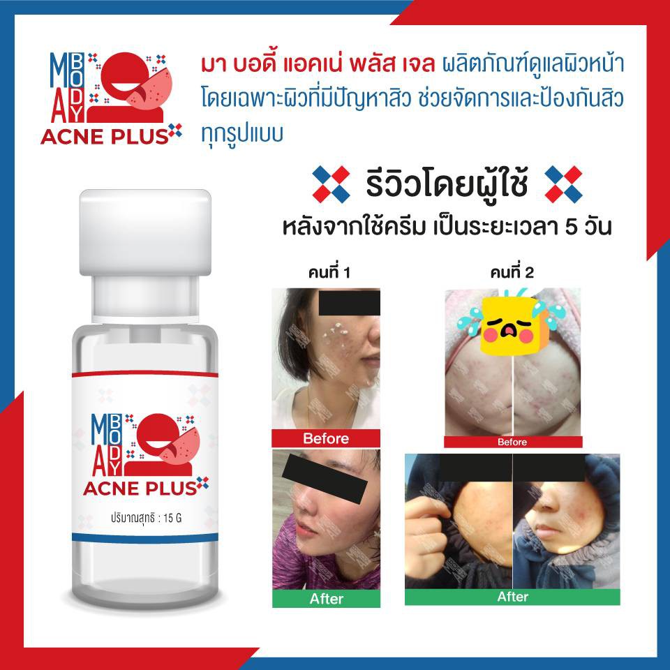 MA BODY ACNE PLUS บำรุงล้ำลึก