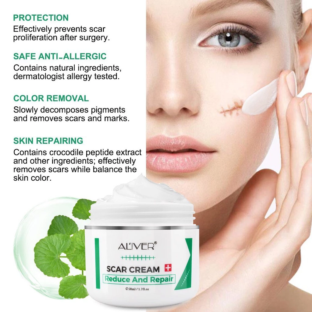 ของแท้ ALIVER ครีมลดรอยแผลเป็น แผลเป็น รแผลไฟไหม้ น้ำร้อนลว แผลผ่าตัด รอยแตกลายหลังครรภ์ แผลเป็นใหม่และแผลเป็นเก่า 50ml