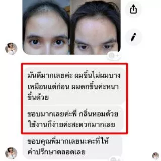โปร🔥ซื้อ​ 1 แถม 1🔥 แชมพูสมุนไพรChaya herb สกัดจากอัญชันช่วยลดผมร่วง เร่งผมยาว ผมดกดำ เงางาม​ ขวดละ360ml