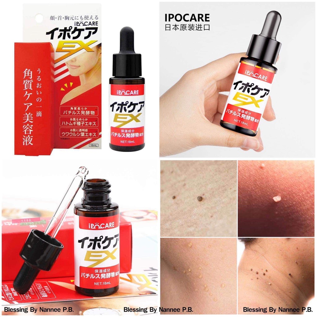 Ipocare Ex 18ml 💰 790.-  ติ่งเนื้อ...ตัวทำลายความมั่นใจ  เซรั่มกำจัดกระ ติ่งเนื้อ ไฝ หูด