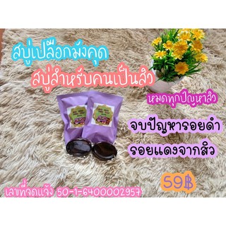 สบู่ลดสิวเปลือกมังคุด DEE. SKIN  ACNE  SOAP(ดีสกินแอคเน่โซพ)