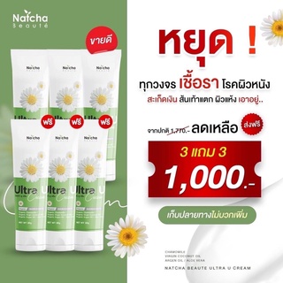 ของแท้100% บอกลา สะ เก็ด เงิน Ultra U อัลตร้ายู ครีมณัชชา ครีมทา เชื้อ รา ที่ผิวหนัง ผิวแห้งคัน ส้นเท้าแตก 3 แถม3 หลอด