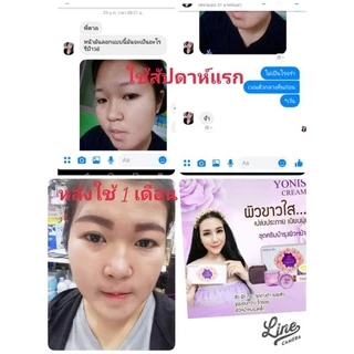 ครีมโยนิเซ่-yonise-cream
