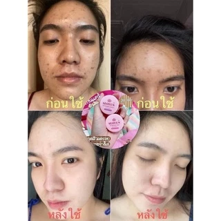 โฉมใหม่‼️ครีมไรยา ครีมริชชี่=ครีมลาน่า LANA เซรั่มมิรา Mira