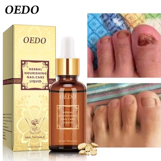 OEDO เซรั่มบำรุงเล็บ น้ำยาบำรุงเล็บ 30ml บำรุงเล็บ ต่อต้านการติตเชื้อรา ซ่อมแซมเล็บแตก เล็บเปราะ เล็บหนา