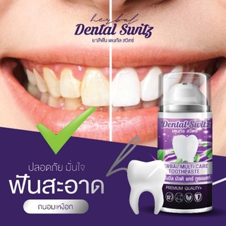 ยาสีฟัน เจลฟอกฟันขาว ซื้อ 1 แถม 1 Dental Switz Herbal ลดแบคทีเรีย ปากหอม 50 g | เจลฟอกฟันขาว Dental