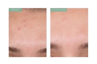 [เหลือ 712.- "เก็บโค้ดทักแชท“] 🔻แพกเกจใหม่&แท้🔻Caudalie Vinopure Clear Skin Purifying Toner 200 ml.
