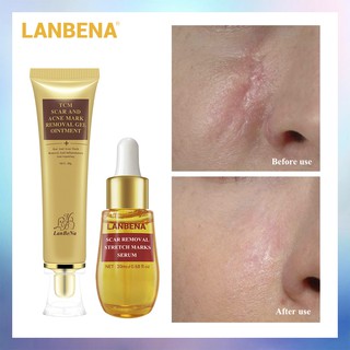 LANBENA Scar Remove Gel+Serum แผลเป็นลบเจล + แผลเป็นลบเซรั่ม