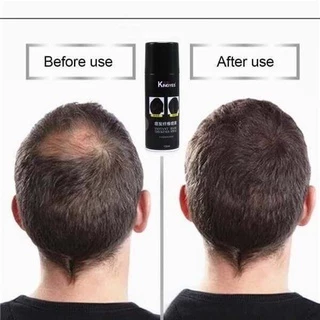 ***พร้อมส่ง***(ขวดใหญ่) kingyesสเปรย์ผม ปิดผมขาว ปิดผมบาง แก้ปัญหาหัวล้าน(ขวดดำ)