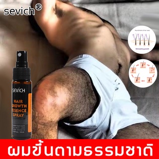 sevich เซรั่มปลูกเครา 30ml ปลูกคิ้ว ปลูกหนวด ขึ้นถาวร น้ำยาปลูกเครา น้ำมันหนวด น้ำมันเครา ยาปลูกคิ้ว ครีมปลูกคิ้ว