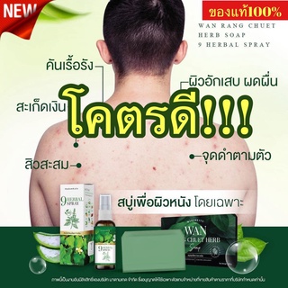 ส่งฟรี! สเปรย์สมุนไพรรักษา กลากเกลื้อน สังคัง สะเก็ดเงิน เชื้อราในร่มผ้า เชื้อราหนังศรีษะ สิวหลัง น้ำเหลืองไม่ดี คอดำ