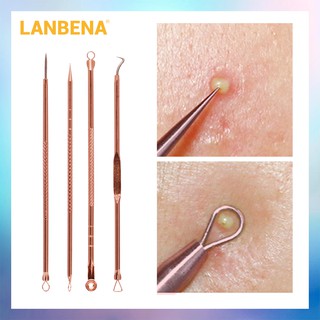 LANBENA 4 ชิ้น Rose Gold เข็มกำจัดสิวสิวเข็ม