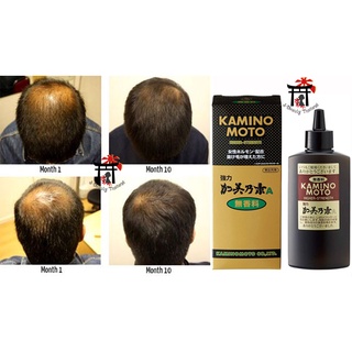 Strong Kaminomoto A Tonic (Higher Strength - Hair Regrowth) เซรั่มปลูกผมจากธรรมชาติ (สูตรไม่มีกลิ่น) ปริมาณ 150 มล.