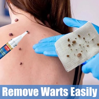 Warts Remover ของแท้ น้ํามันถั่วเหลือง วอร์ท กําจัดวอร์ท และแท็ก ผิวหนัง ครีมหูด วอร์ท เมจิก กําจัด แท็ก ผิว การเจริญเติบโต ไฝ และวอร์ท กําจัดหูด ทรีทเม้นท์