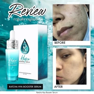 Ratcha Hya Booster Serum เซรั่มไฮยา บูสเตอร์ By น้องฉัตร (15 ml. x 1 กล่อง)