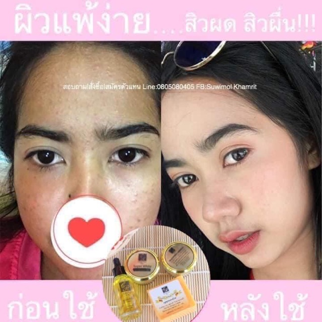 ครีมคริสตัลออร่าสกิน Crystal Aura Skin ครีมหน้าใส ขนาด5g ราคา ถูกที่สุด ดีลบีเคเค แกลเลอรีภาพที่ 3
