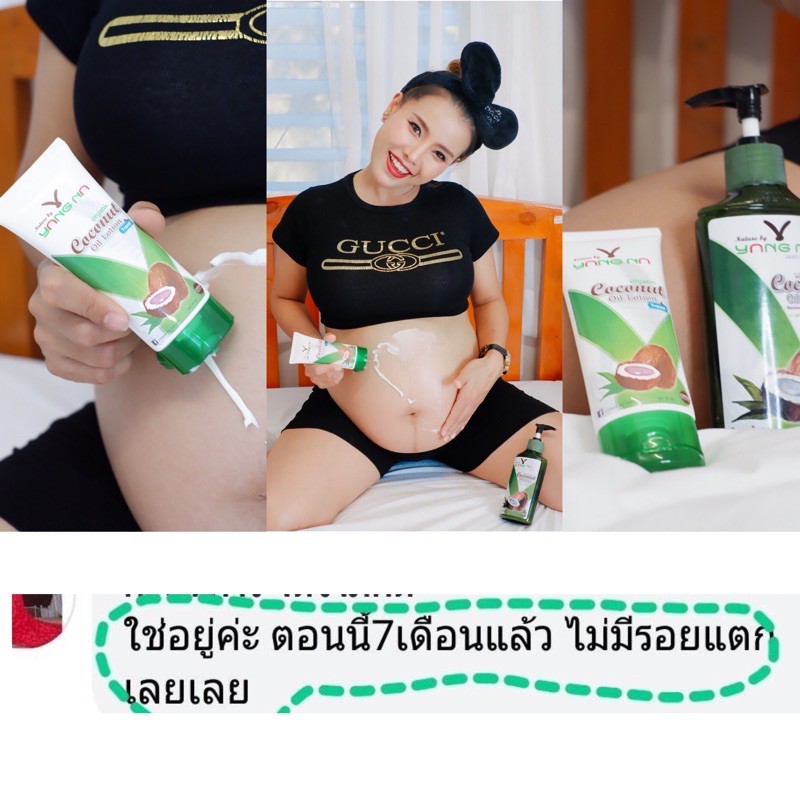 ท้องแตกลาย ท้องโต คันท้อง โลชั่นมะพร้าว โลชั่นคนท้อง ครีมทาท้อง ครีมกันท้องแตกลาย