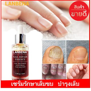 💅[แท้]เซรั่มแก้เชื้อรา บำรุงเล็บ รักษาเล็บขบ lanbena nail repair essence serum ซ่อมแซมเล็บ  รักษาโรคเชื้อราที่เล็บ12มล.