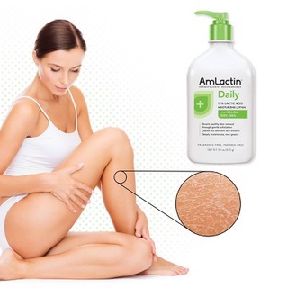 Amlactin Moisturizing Body Lotion สูตร Daily ขนาด 567ml. ครีมทาขนคุด ของแท้จากอเมริกา!หมดอายุ2025