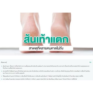 ที่ขูดส้นเท้า ใบมีดขูดส้นเท้า Pedi Solingen กล่องเล็ก ใบมีด ขูดส้นเท้า ปีดี เพดิ โซชินเจน