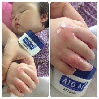 [ของแท้ 100%]Ato Ai Balm อโทอายบาล์ม ใช้ได้ตั้งแต่แรกเกิด