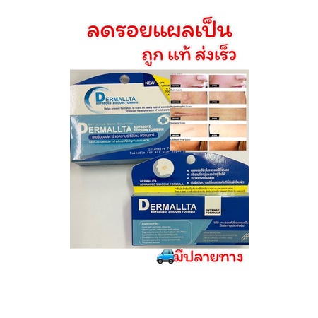 ถูก แท้ ส่งเร็ว   Dermallta เจลรักษาแผลเป็นสูตรเข้มข้น ลดรอยแผลเป็น รอยสิว ได้เป็นอย่างดี ขนาด 10 กรัม – โปรปัง