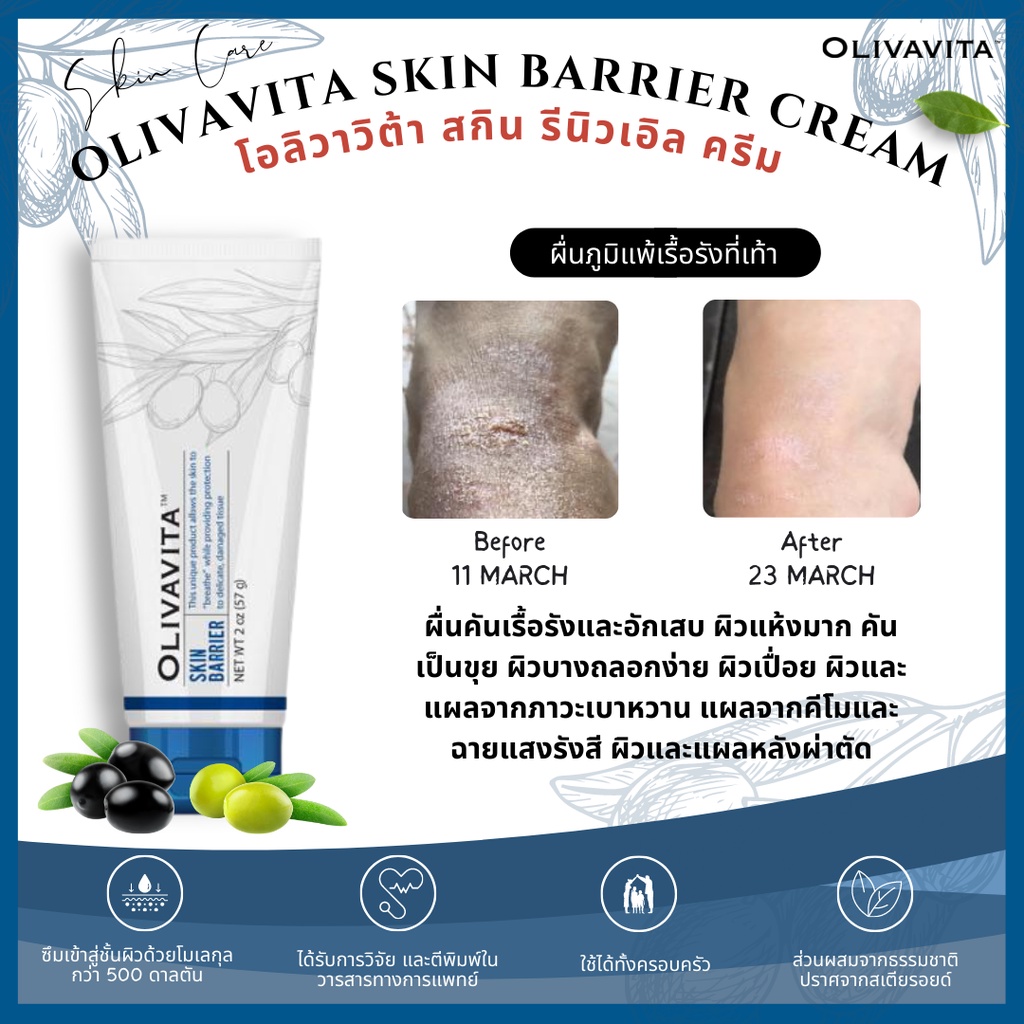 พร้อมส่ง โอลิวาวิต้าฝาน้ำเงิน(Olivavita) ครีมสำหรับผิวแห้งลอกคัน ผื่นภูมิแพ้ผิวหนัง แผลเบาหวาน แผลคีโมฉายแสง