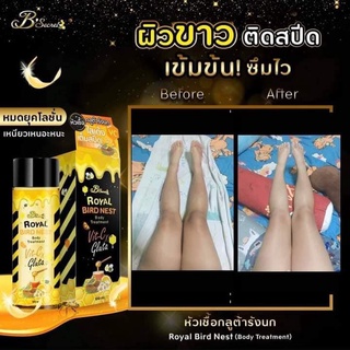 Royal Bird Nest Body Treatment หัวเชื้อกลูต้ารังนก