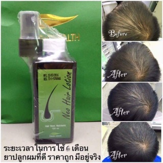 💦#สเปรย์ปลูกผมนีโอแฮร์ Neo Hair Lotion💦