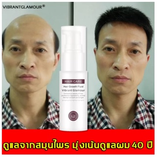 ของแท้100%！ VG เซรั่มปลูกผม ปลูกผม น้ำยาเร่งผมยาว ป้องกันผมร่วง ทำให้รากผมแข็งแรงมากขึ้น ปลูกผมหนาขึ้นใหม่ บำรุงรากผม